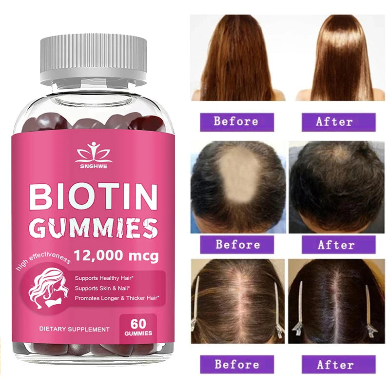 Collagen & Biotin Gummies – Hair, Skin, Nails & Joint Support with Blueberry Flavor